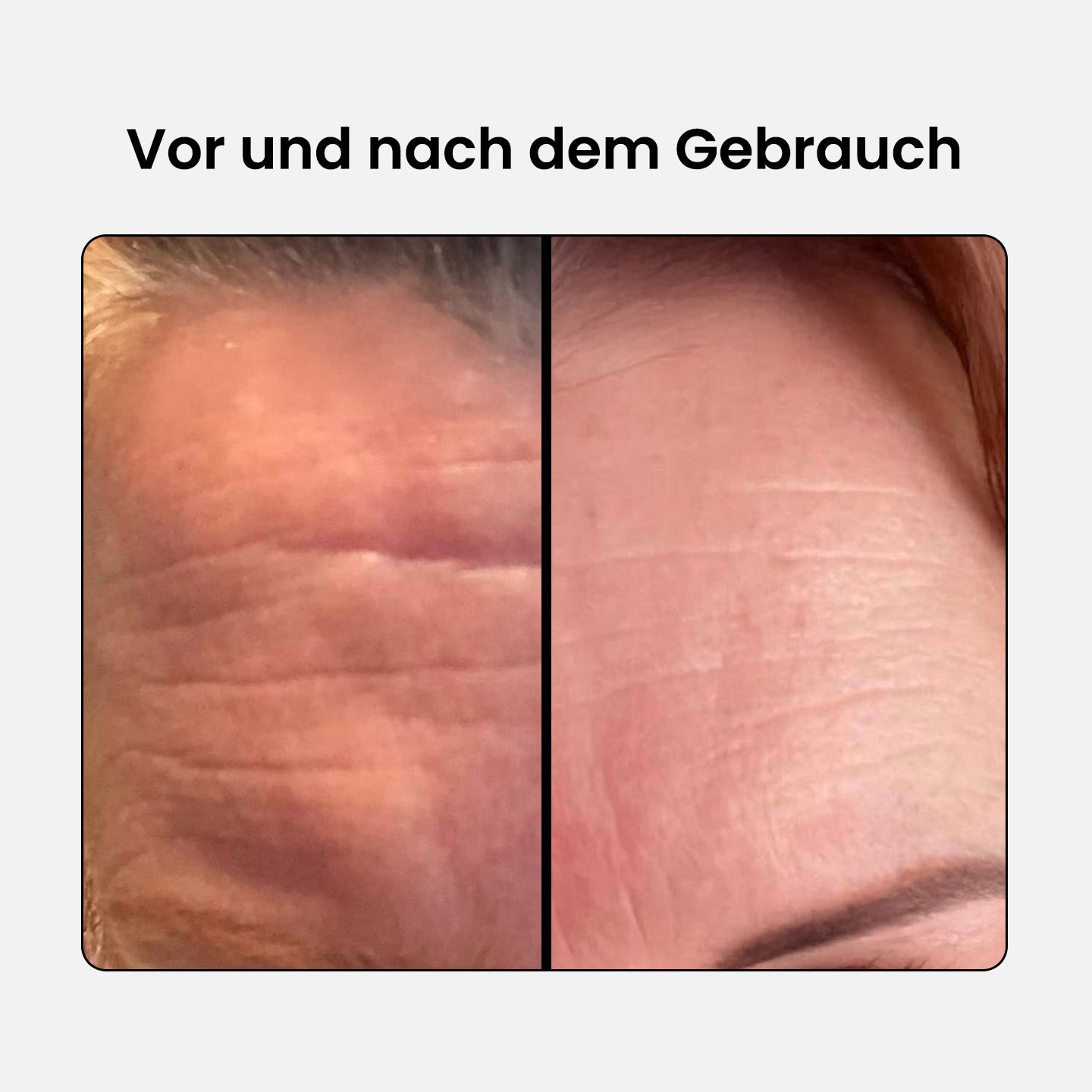 Anti-Aging Schönheits Kollagen Komplex - Regular