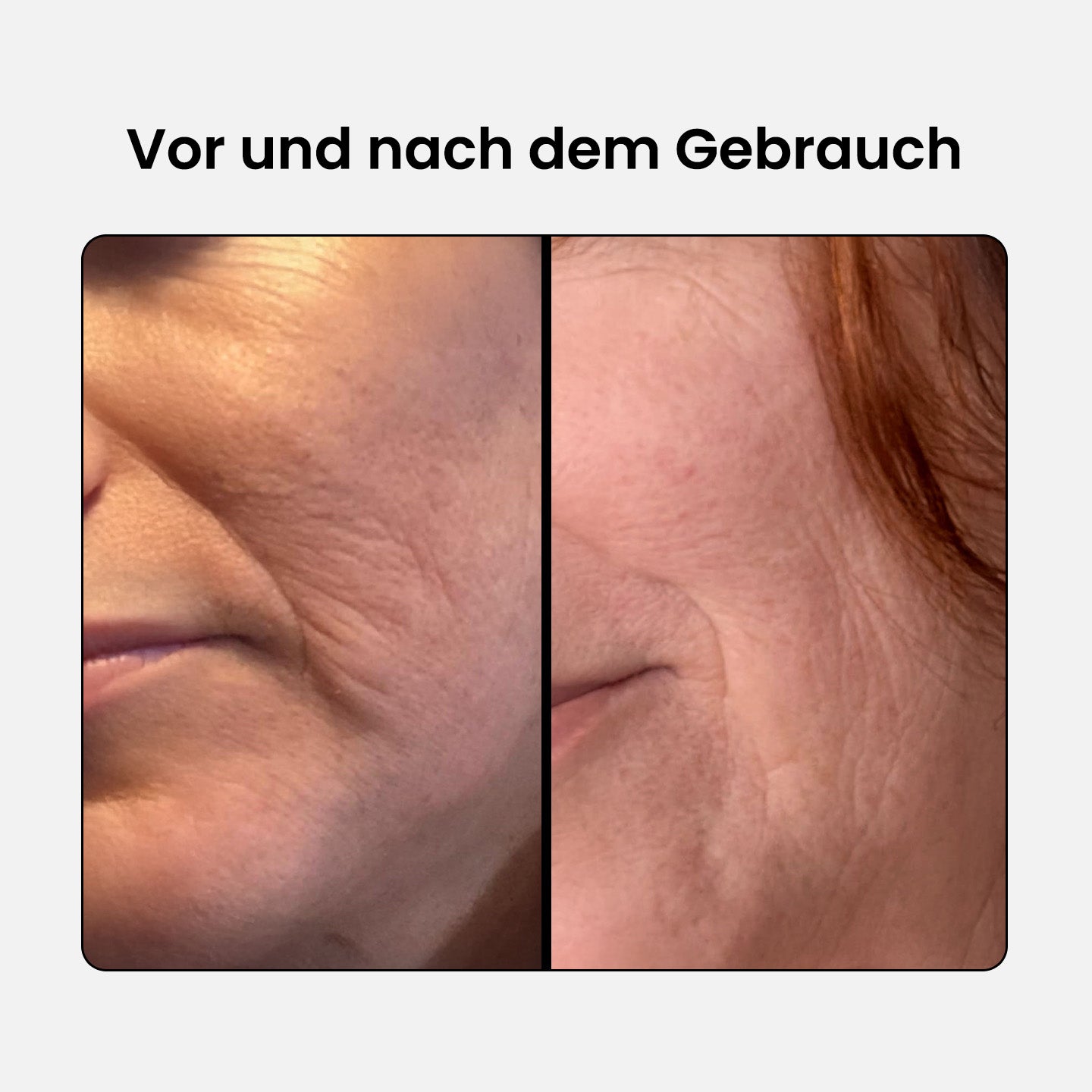 Anti-Aging Schönheits Kollagen Komplex - Regular