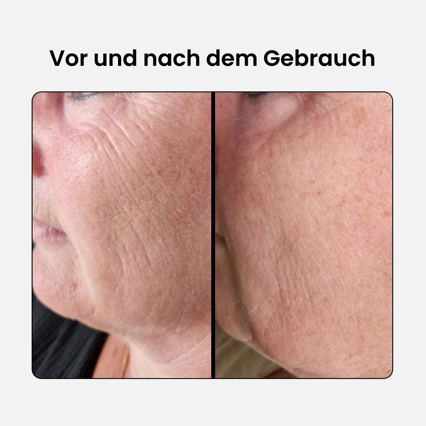 Anti-Aging Schönheits Kollagen Komplex - Advanced
