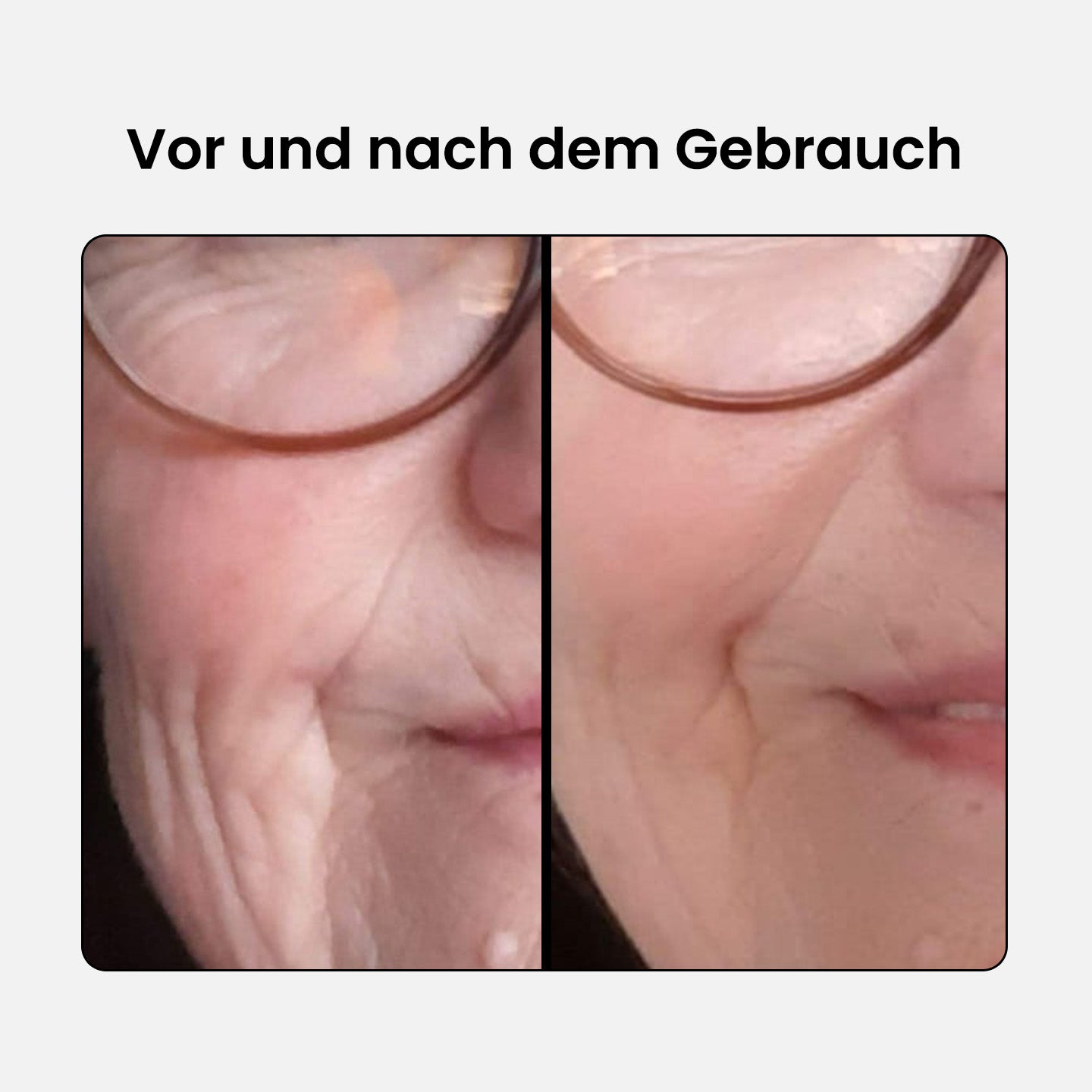 Anti-Aging Schönheits Kollagen Komplex - Advanced