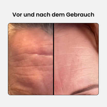 Anti-Aging Schönheits Kollagen Komplex - Advanced
