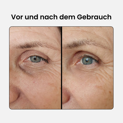 Lifting Augenserum – 5 % Koffein + EGCG